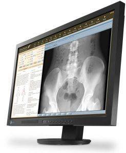 EIZO MS230W DVI + DP 23\'\' BLACK EIZO MS230W DVI + DP 23\'\' BLACK